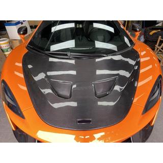 Cofano (Carbonio) McLaren 540C/570S 2015-2020 foto 2